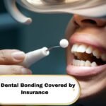 Is Dental Bonding Covered by Insurance